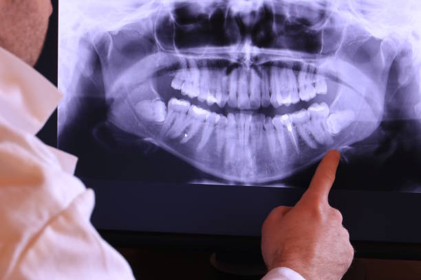 Best Emergency Cosmetic Dentistry in Aurora, OH